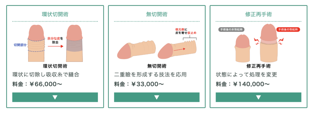 東京ノーストクリニックの包茎手術の詳細に関する画像